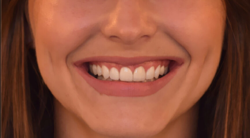 Philip Friel Advanced Dentistry - After