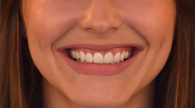 Philip Friel Advanced Dentistry - After