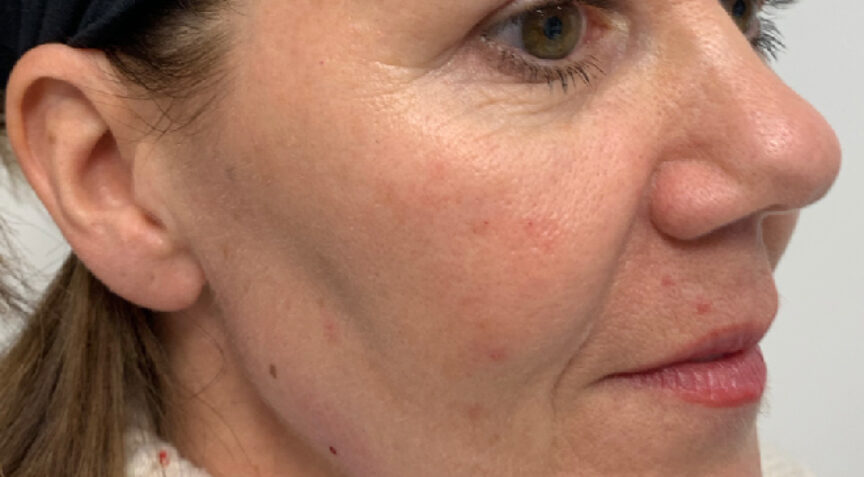 Philip Friel Advanced Dentistry - After