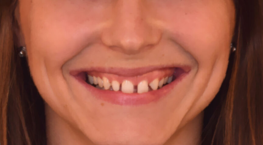 Philip Friel Advanced Dentistry - Before