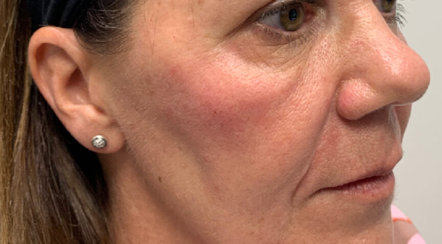 Philip Friel Advanced Dentistry - Before