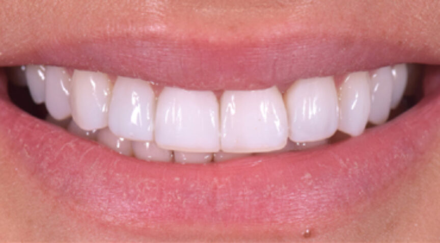 Philip Friel Advanced Dentistry - After