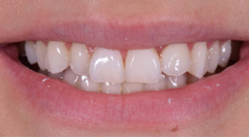 Philip Friel Advanced Dentistry - Before