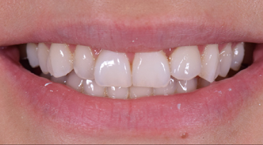 Philip Friel Advanced Dentistry - Before