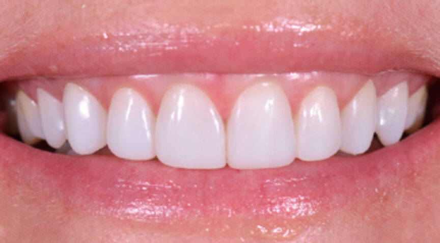 Philip Friel Advanced Dentistry - After