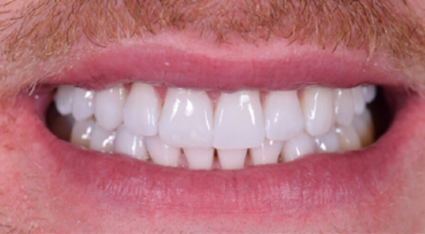 Philip Friel Advanced Dentistry - After