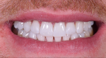 Philip Friel Advanced Dentistry - After