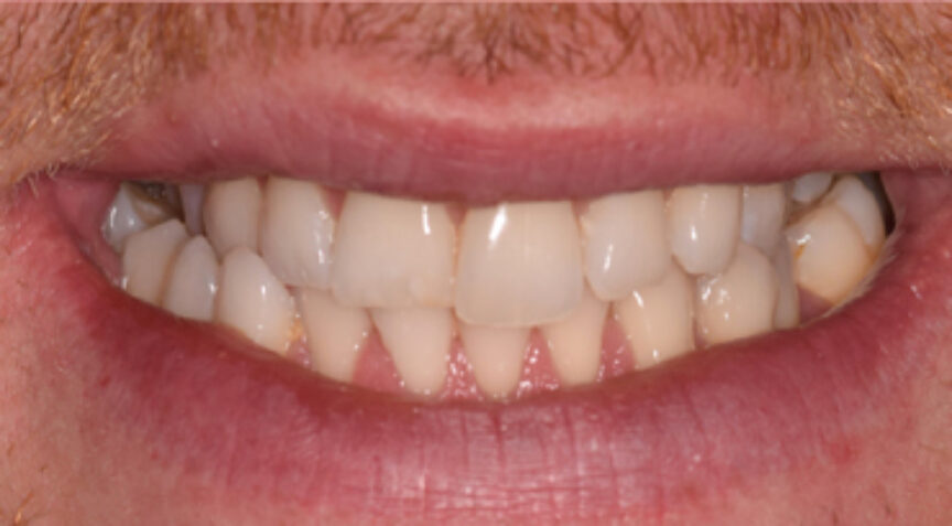 Philip Friel Advanced Dentistry - Before