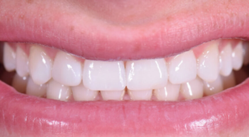 Philip Friel Advanced Dentistry - After