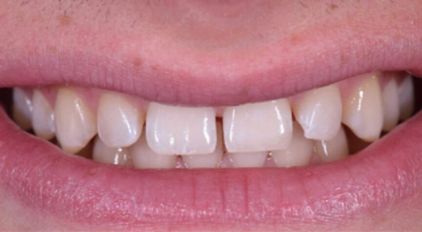 Philip Friel Advanced Dentistry - Before