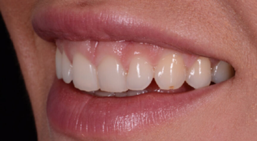 Philip Friel Advanced Dentistry - Before