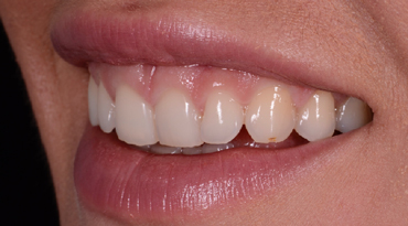 Philip Friel Advanced Dentistry - Before