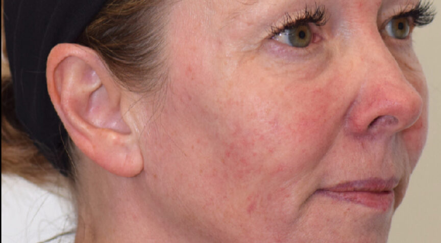 Philip Friel Advanced Dentistry - After