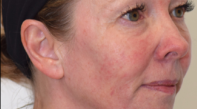 Philip Friel Advanced Dentistry - After