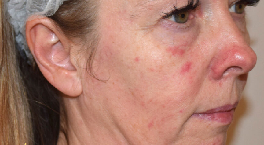 Philip Friel Advanced Dentistry - Before