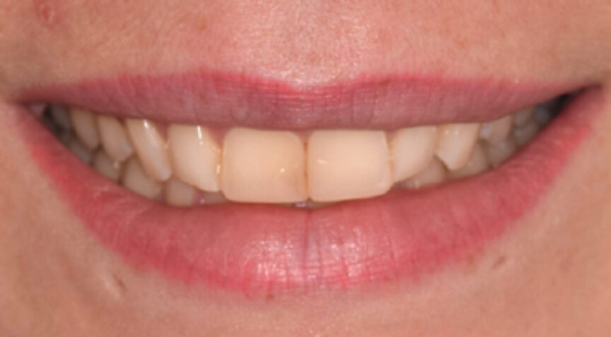 Philip Friel Advanced Dentistry - Before