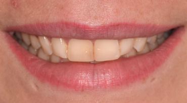 Philip Friel Advanced Dentistry - Before