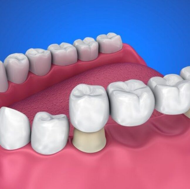 Philip Friel Advanced Dentistry - treatment