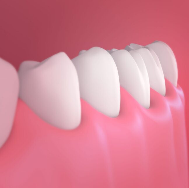 Philip Friel Advanced Dentistry - treatment