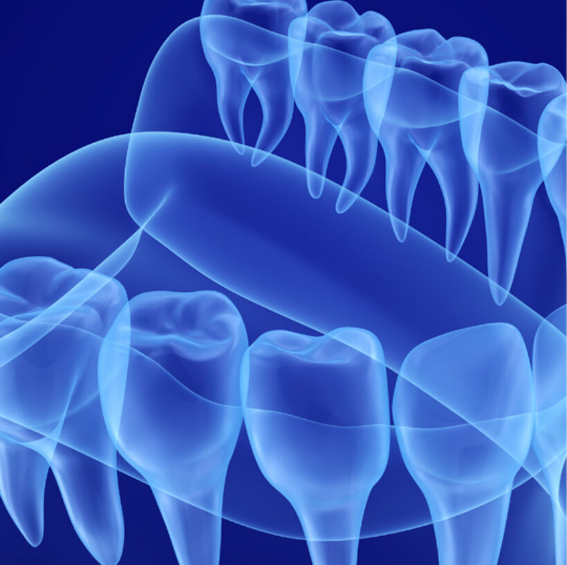 Advanced Dentistry Dental