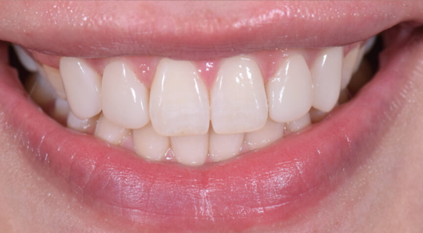 Philip Friel Advanced Dentistry - After