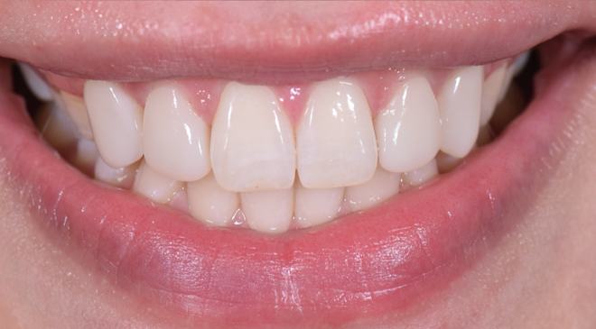 Philip Friel Advanced Dentistry - After