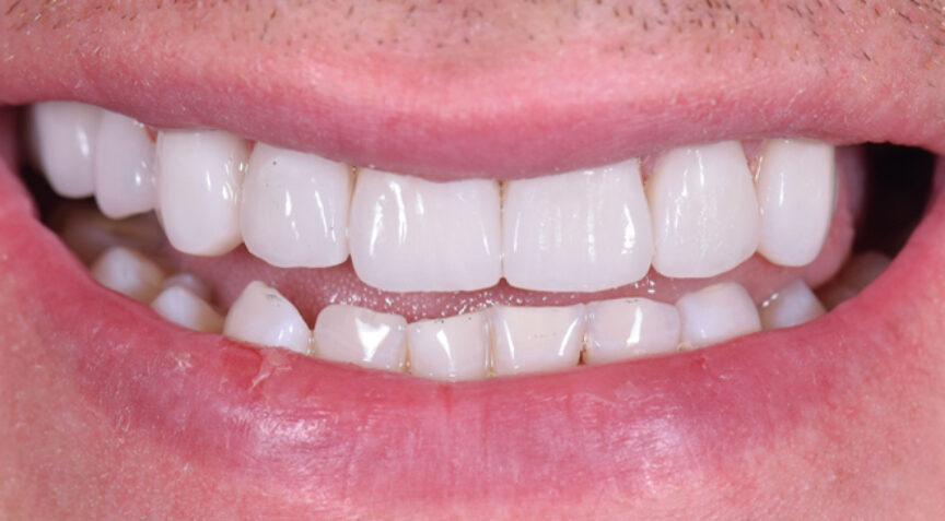 Philip Friel Advanced Dentistry - After