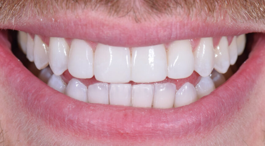 Philip Friel Advanced Dentistry - After