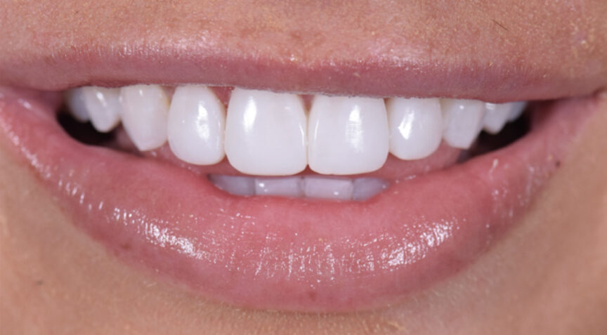 Philip Friel Advanced Dentistry - After