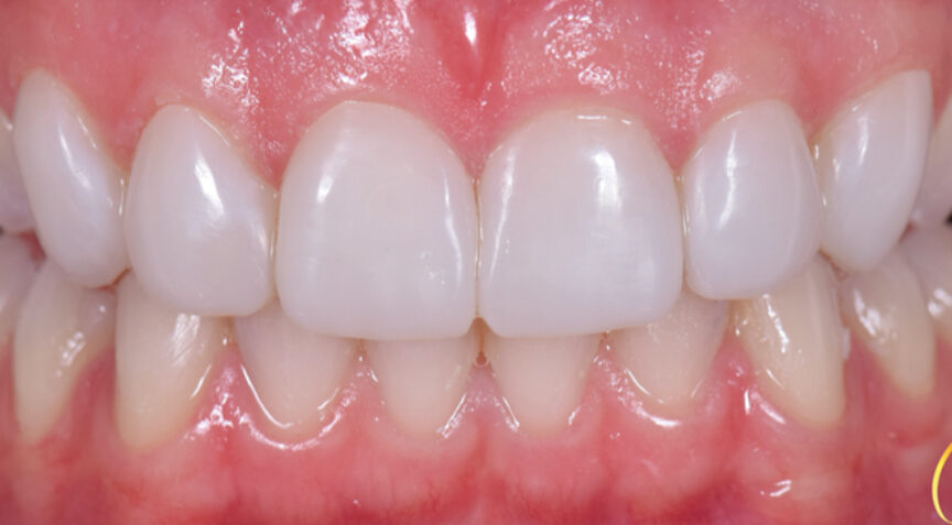 Philip Friel Advanced Dentistry - After