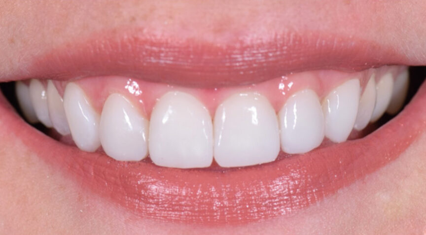 Philip Friel Advanced Dentistry - After