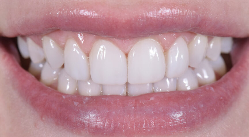 Philip Friel Advanced Dentistry - After