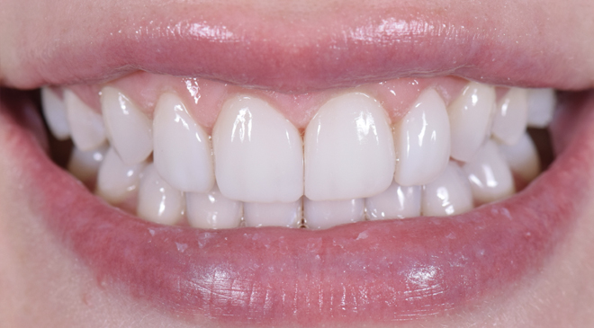 Philip Friel Advanced Dentistry - After