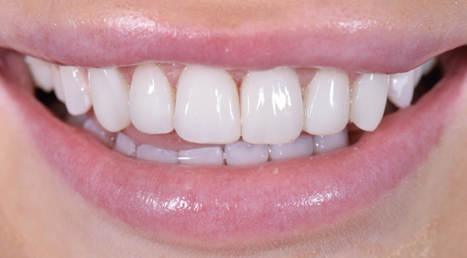 Philip Friel Advanced Dentistry - After