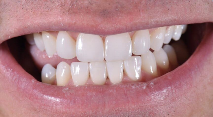 Philip Friel Advanced Dentistry - After