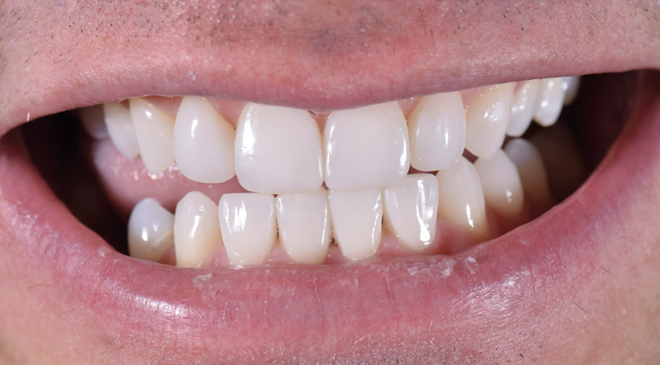 Philip Friel Advanced Dentistry - After