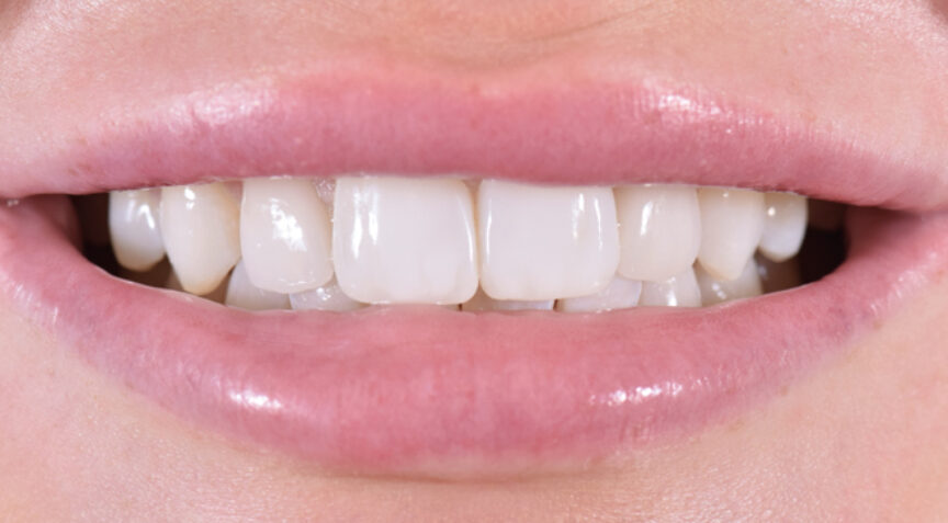 Philip Friel Advanced Dentistry - After