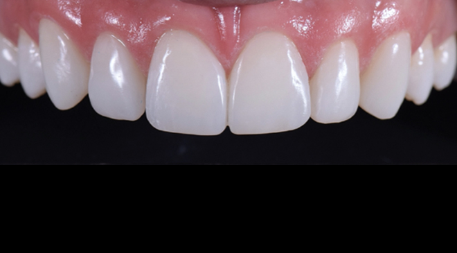 Philip Friel Advanced Dentistry - After