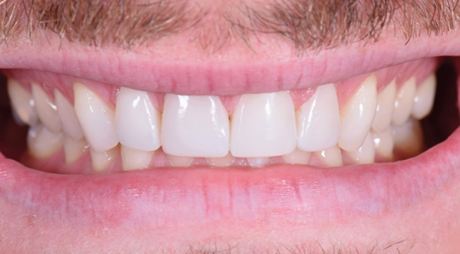 Philip Friel Advanced Dentistry - After