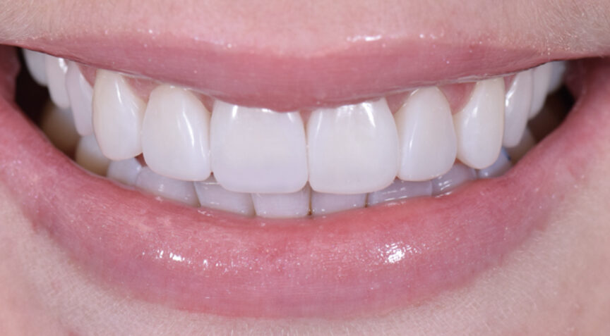 Philip Friel Advanced Dentistry - After