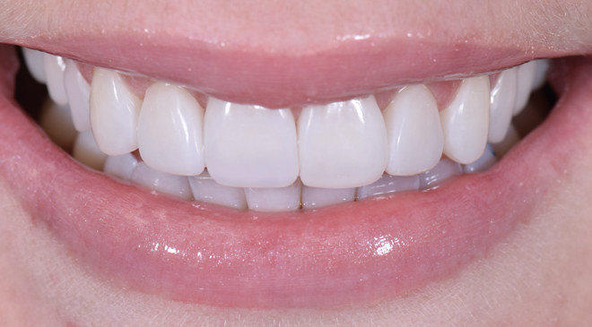 Philip Friel Advanced Dentistry - After
