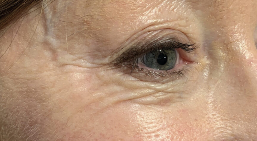 Philip Friel Advanced Dentistry - After