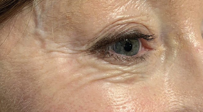 Philip Friel Advanced Dentistry - After