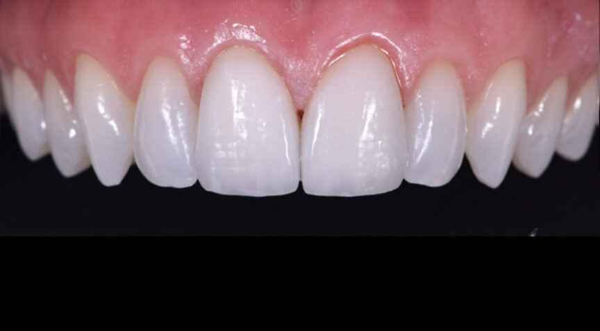 Philip Friel Advanced Dentistry - After
