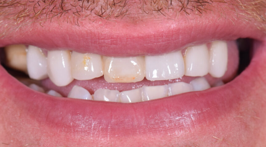 Philip Friel Advanced Dentistry - Before
