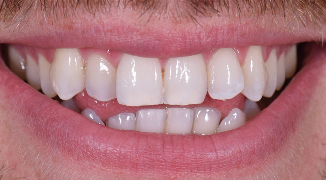 Philip Friel Advanced Dentistry - Before