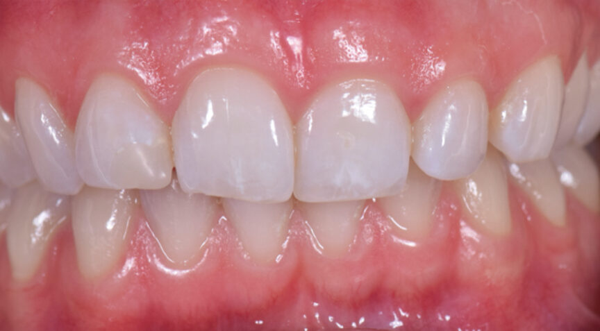 Philip Friel Advanced Dentistry - Before