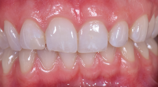 Philip Friel Advanced Dentistry - Before