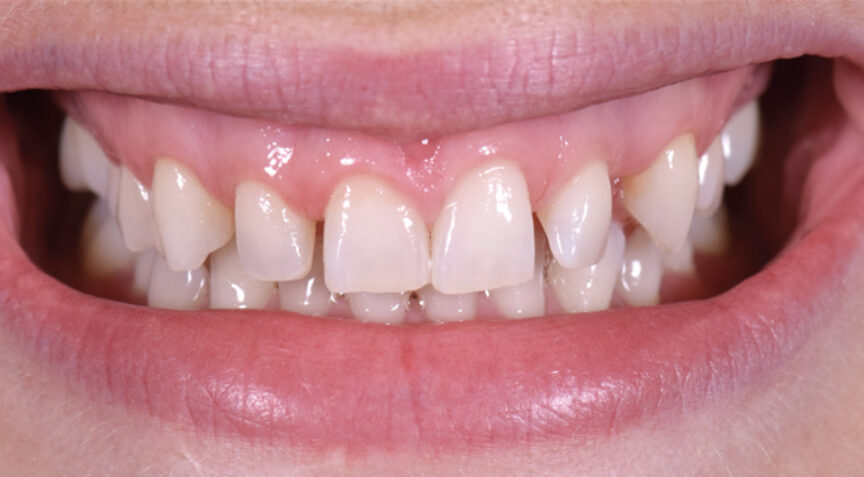 Philip Friel Advanced Dentistry - Before