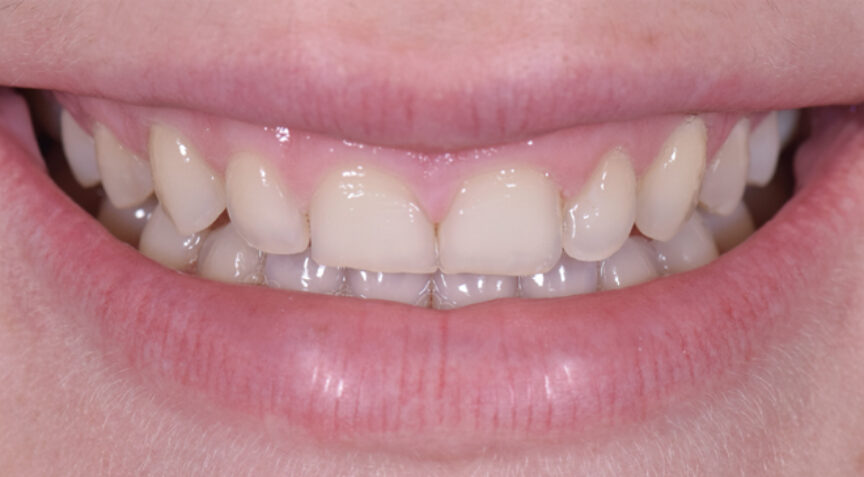 Philip Friel Advanced Dentistry - Before